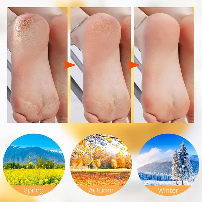 🔥Moisturizing Foot Mask Exfoliating Silicone Socks